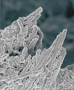 False colour image of calcium phosphate deposits on bone