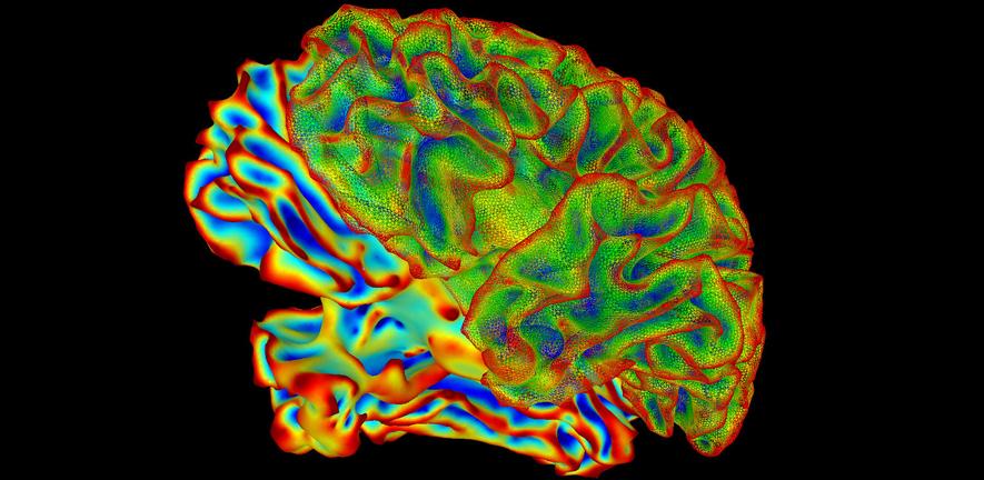 Multi-coloured suma lateral whole brain image