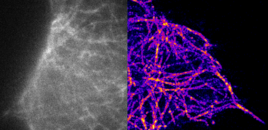 Images of soluble tau using conventional microscopy (left) and super resolution microscopy (right), courtesy Klenerman Lab