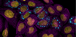 Cells with visible cell body, nucleus and condensates.