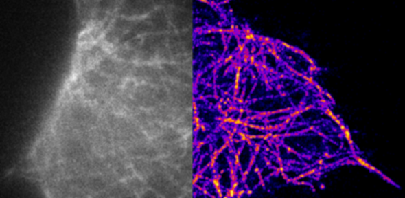 microscopic views of tau aggregates, blurred on left and clearer on right