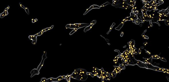 Alpha-synuclein oligomers (yellow) inside microglia, the brain’s immune cells